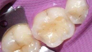 Case 2